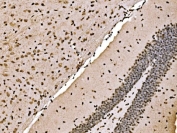IHC staining of FFPE mouse brain tissue with SPHK1 antibody. HIER: boil tissue sections in pH8 EDTA for 20 min and allow to cool before testing.