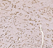 IHC staining of FFPE rat brain tissue with SPHK1 antibody. HIER: boil tissue sections in pH8 EDTA for 20 min and allow to cool before testing.