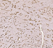 IHC staining of FFPE rat brain tissue with SPHK1 antibody. HIER: boil tissue sections in pH8 EDTA for 20 min and allow to cool before testing.