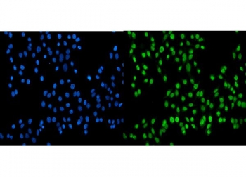 Immunofluorescent staining of FFPE human Caco-2 cells with SSB antibody (green) and DAPI nuclear stain (blue). HIER: steam section in pH6 citrate buffer for 20 min.