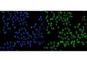 Immunofluorescent staining of FFPE human Caco-2 cells with SSB antibody (green) and DAPI nuclear stain (blue). HIER: steam section in pH6 citrate buffer for 20 min.
