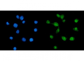 Immunofluorescent staining of FFPE human Caco-2 cells with TAF8 antibody (green) and DAPI nuclear stain (blue). HIER: steam section in pH6 citrate buffer for 20 min.