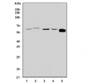 Western blot testing of 1) rat liver, 2) mouse kidney, 3) mouse HEPA1-6, 4) rat thymus and 5) mouse thymus tissue lysate with Zbp1 antibody. Predicted molecular weight: 15-49 kDa (multiple isoforms) but can be observed at up to ~60 kDa.