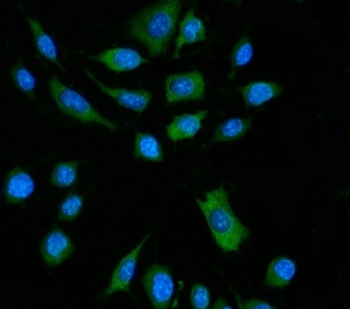 Immunofluorescent staining of FFPE mouse RM-1 cells with Zbp1 antibody (green) and DAPI nuclear stain (blue). HIER: steam section in pH6 citrate buffer for 20 min.~