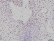 IHC staining of FFPE human spleen tissue with RAB11A antibody. HIER: boil tissue sections in pH8 EDTA for 20 min and allow to cool before testing.
