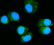 Immunofluorescent staining of FFPE human T-47D cells with RAB11A antibody (green) and DAPI nuclear stain (blue). HIER: steam section in pH6 citrate buffer for 20 min.