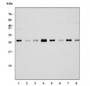 Western blot testing of 1) human HeLa, 2) human placenta, 3) human COLO-320, 4) human MDA-MB-453, 5) rat testis, 6) rat brain, 7) mouse testis and 8) mouse brain tissue lysate with RAB11A antibody. Predicted molecular weight: ~25 kDa.