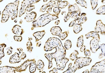 IHC staining of FFPE human placental tissue with Cyclophilin E antibody. HIER: boil tissue sections in pH8 EDTA for 20 min and allow to cool before testing.