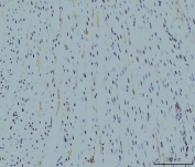 IHC staining of FFPE rat heart tissue with PPIE antibody. HIER: boil tissue sections in pH8 EDTA for 20 min and allow to cool before testing.