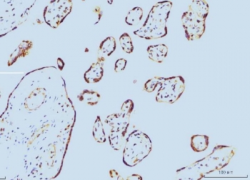 IHC staining of FFPE human placental tissue with PPIE antibody. HIER: boil tissue sections in pH8 EDTA for 20 min and allow to cool before testing.