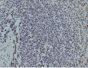 IHC staining of FFPE human spleen tissue with LSM8 antibody. HIER: boil tissue sections in pH8 EDTA for 20 min and allow to cool before testing.