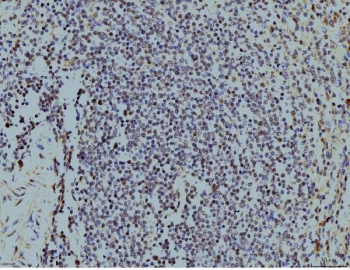 IHC staining of FFPE human spleen tissue with LSM8 antibody. HIER: boil tissue sections in pH8 EDTA for 20 min and allow to cool before testing.