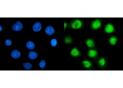 Immunofluorescent staining of FFPE human MCF7 cells with PSMC3 antibody (green) and DAPI nuclear stain (blue). HIER: steam section in pH6 citrate buffer for 20 min.