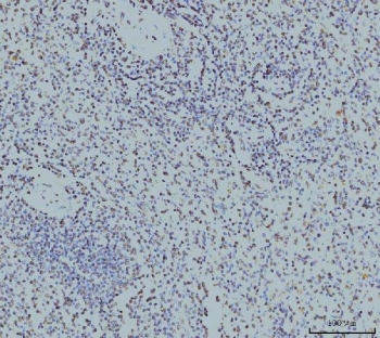 IHC staining of FFPE human spleen tissue with Replication Protein A2 antibody. HIER: boil tissue sections in pH8 EDTA for 20 min and allow to cool before testing.