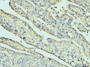 IHC staining of FFPE human liver tissue with Annexin VI antibody. HIER: boil tissue sections in pH8 EDTA for 20 min and allow to cool before testing.
