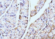 IHC staining of FFPE rat pancreas tissue with Annexin VI antibody. HIER: boil tissue sections in pH8 EDTA for 20 min and allow to cool before testing.