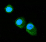 Immunofluorescent staining of FFPE human T-47D cells with Annexin VI antibody (green) and DAPI nuclear stain (blue). HIER: steam section in pH6 citrate buffer for 20 min.