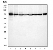 Western blot testing of 1) human placenta, 2) human U-87 MG, 3) human HepG2, 4) human HeLa, 5) rat thymus, 6) rat pancreas, 7) mouse thymus and 8) mouse pancreas tissue lysate with Annexin VI antibody. Expected molecular weight: 67-76 kDa.