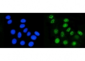 Immunofluorescent staining of FFPE human MCF7 cells with DHODH antibody (green) and DAPI nuclear stain (blue). HIER: steam section in pH6 citrate buffer for 20 min.