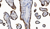 IHC staining of FFPE human placental tissue with Cytochrome P450 Reductase antibody. HIER: boil tissue sections in pH8 EDTA for 20 min and allow to cool before testing.
