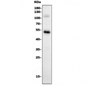Western blot testing of human HepG2 cell lysate with FGG antibody. Predicted molecular weight ~52 kDa.
