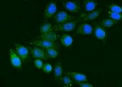 Immunofluorescent staining of FFPE human Hep3B cells with FGG antibody (green) and DAPI nuclear stain (blue). HIER: steam section in pH6 citrate buffer for 20 min.