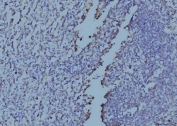 IHC staining of FFPE human tonsil tissue with EIF4A1 antibody. HIER: boil tissue sections in pH8 EDTA for 20 min and allow to cool before testing.
