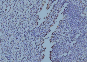 IHC staining of FFPE human tonsil tissue with EIF4A1 antibody. HIER: boil tissue sections in pH8 EDTA for 20 min and allow to cool before testing.