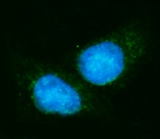Immunofluorescent staining of FFPE human Hep3B cells with EIF4A1 antibody (green) and DAPI nuclear stain (blue). HIER: steam section in pH6 citrate buffer for 20 min.