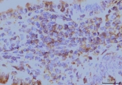 IHC staining of FFPE mouse colon tissue with EIF4A1 antibody. HIER: boil tissue sections in pH8 EDTA for 20 min and allow to cool before testing.
