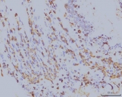 IHC staining of FFPE rat colon tissue with EIF4A1 antibody. HIER: boil tissue sections in pH8 EDTA for 20 min and allow to cool before testing.