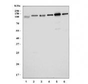 Western blot testing of 1) human HepG2, 2) human HEK293, 3) rat liver, 4) rat kidney, 5) mouse liver and 6) mouse kidney tissue lysate with AASS antibody. Predicted molecular weight ~102 kDa.