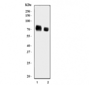 Western blot testing of human 1) U-87 MG and 2) A431 cell lysate with ADAM9 antibody. Molecular weight: 90-100 kDa (pro-ADAM9-L form) and 70-80 kDa (ADMA9-L form).