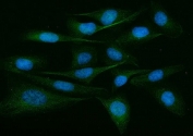 Immunofluorescent staining of FFPE human U-2 OS cells with ADAM9 antibody (green) and DAPI nuclear stain (blue). HIER: steam section in pH6 citrate buffer for 20 min.