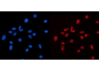 Immunofluorescent staining of FFPE human MCF7 cells with AKAP 95 antibody (red) and DAPI nuclear stain (blue). HIER: steam section in pH6 citrate buffer for 20 min.
