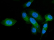 Immunofluorescent staining of FFPE human PC-3 cells with AP2A2 antibody (green) and DAPI nuclear stain (blue). HIER: steam section in pH6 citrate buffer for 20 min.