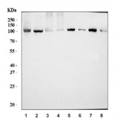 Western blot testing of 1) human HepG2, 2) human HEK293, 3) human PC-3, 4) human SH-SY5Y, 5) rat brain, 6) rat lung, 7) mouse brain and 8) mouse lung tissue lysate with AP2A2 antibody. Predicted molecular weight ~104 kDa.