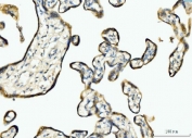IHC staining of FFPE human placental tissue with BCKDK antibody. HIER: boil tissue sections in pH8 EDTA for 20 min and allow to cool before testing.
