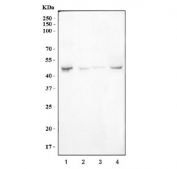 Western blot testing of 1) human HepG2, 2) rat kidney, 3) mouse kidney and 4) mouse RAW264.7 cell lysate with BCKDK antibody. Predicted molecular weight ~46 kDa.