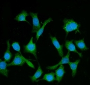 Immunofluorescent staining of FFPE human Caco-2 cells with BIN1 antibody (green) and DAPI nuclear stain (blue). HIER: steam section in pH6 citrate buffer for 20 min.