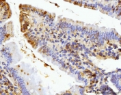 IHC staining of FFPE mouse colon tissue with BZW2 antibody. HIER: boil tissue sections in pH8 EDTA for 20 min and allow to cool before testing.