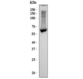 Western blot testing of human HepG2 cell lysate with Liver Carboxylesterase 1 antibody. Predicted molecular weight ~63 kDa.