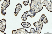 IHC staining of FFPE human placental tissue with CYB5B antibody. HIER: boil tissue sections in pH8 EDTA for 20 min and allow to cool before testing.