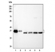 Western blot testing of 1) human HepG2, 2) human A431, 3) rat liver, 4) rat lung, 5) mouse liver and 6) mouse lung tissue lysate with CYB5R3 antibody. Predicted molecular weight: 32-38 kDa (multiple isoforms).