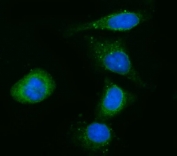 Immunofluorescent staining of FFPE human Hep3B cells with CYB5R3 antibody (green) and DAPI nuclear stain (blue). HIER: steam section in pH6 citrate buffer for 20 min.