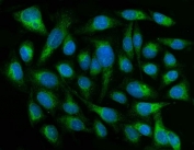 Immunofluorescent staining of FFPE human U-2 OS cells with CYB5R3 antibody (green) and DAPI nuclear stain (blue). HIER: steam section in pH6 citrate buffer for 20 min.