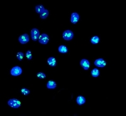 Immunofluorescent staining of FFPE human Caco-2 cells with DDX21 antibody (green) and DAPI nuclear stain (blue). HIER: steam section in pH6 citrate buffer for 20 min.