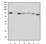 Western blot testing of 1) human HeLa, 2) human A431, 3) human Caco-2, 4) rat brain, 5) rat testis, 6) mouse brain and 7) mouse testis tissue lysate with E2F1 antibody. Predicted molecular weight: 48-70 kDa.