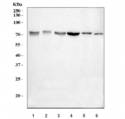Western blot testing of 1) human 293T, 2) human SK-O-V3, 3) human K562, 4) human HEL, 5) rat brain and 6) mouse brain tissue lysate with E2F3 antibody. Predicted molecular weight: ~49 kDa but can also be observed from 56~66 kDa.