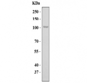 Western blot testing of human K562 cell lysate with EDEM3 antibody. Predicted molecular weight ~105 kDa.